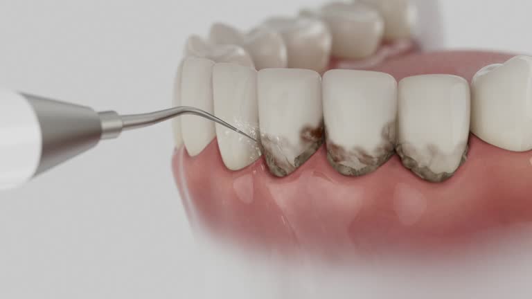 Reliable Dental contractor in Lakewood, WA by Dentist Open Now